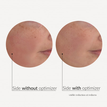 MESO'ME TIGHT - Anti-Wrinkle Revolution