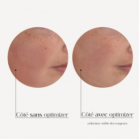 MESO'ME TIGHT - Anti-Wrinkle Revolution