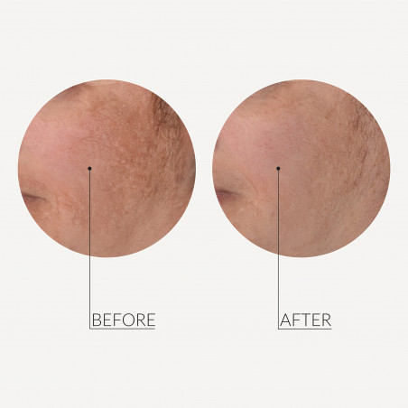 MESO'ME TIGHT - Anti-Wrinkle Revolution