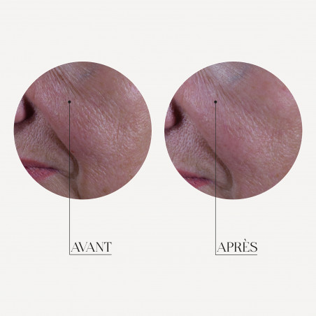 MESO'ME TIGHT - Anti-Wrinkle Revolution