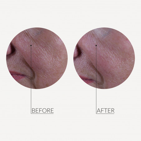 MESO'ME TIGHT - Anti-Wrinkle Revolution